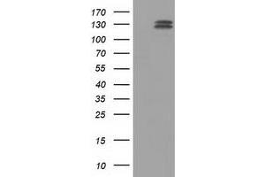 Western Blotting (WB) image for anti-L1 Cell Adhesion Molecule (L1CAM) antibody (ABIN1499085) (L1CAM anticorps)