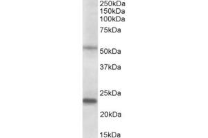 Western Blotting (WB) image for anti-Matrix Metallopeptidase 3 (Stromelysin 1, Progelatinase) (MMP3) (AA 459-473), (C-Term) antibody (ABIN2465159) (MMP3 anticorps  (C-Term))