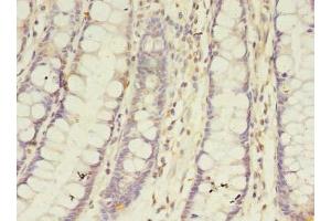 Immunohistochemistry of paraffin-embedded human colon tissue using ABIN7145877 at dilution of 1:100 (BTN2A1 anticorps  (AA 29-248))