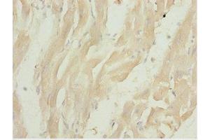 Immunohistochemistry of paraffin-embedded human heart tissue using ABIN7158223 at dilution of 1:100