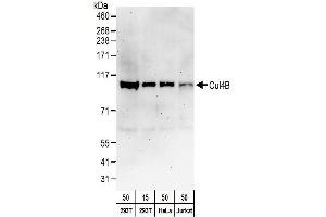 Western Blotting (WB) image for anti-Cullin 4B (CUL4B) (AA 50-100) antibody (ABIN7453068)