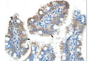 anti-Obg-Like ATPase 1 (OLA1) (AA 104-153) antibody