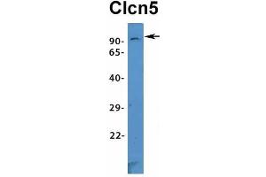 Host:  Rabbit  Target Name:  Clcn5  Sample Type:  Mouse Kidney  Antibody Dilution:  1.