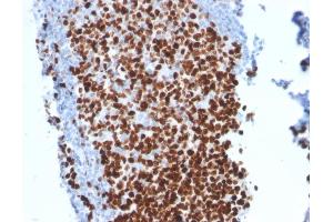 Formalin-fixed, paraffin-embedded human Tonsil stained with Ki67-Monospecific Mouse Monoclonal Antibody (MKI67/2462). (Ki-67 anticorps  (AA 2293-2478))