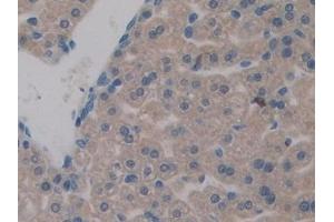 Detection of DAPP1 in Mouse Liver Tissue using Polyclonal Antibody to Dual Adaptor Of Phosphotyrosine And 3-Phosphoinositides (DAPP1)