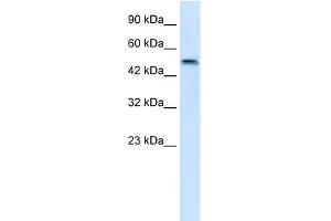 WB Suggested Anti-SBZF3 Antibody Titration:  1. (ZNF695 anticorps  (N-Term))
