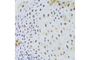 Immunohistochemistry of paraffin-embedded human esophagus using KRT8 Antibody.