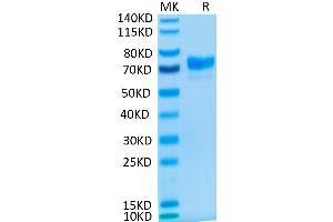 SDS-PAGE (SDS) image for Mesothelin (MSLN) protein (Fc Tag) (ABIN7275282)