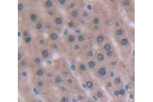 Used in DAB staining on fromalin fixed paraffin- embedded Kidney tissue