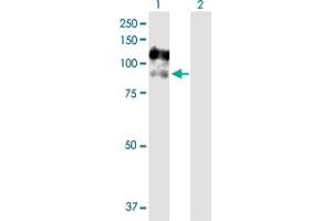 Western Blot analysis of CSF3R expression in transfected 293T cell line by CSF3R MaxPab polyclonal antibody. (CSF3R anticorps  (AA 1-836))