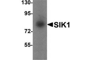 Western blot analysis of SIK1 in human small intestine tissue lysate with SIK1 antibody at 1 μg/ml. (SIK1 anticorps  (Center))