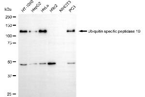 Western blotting analysis using ubiquitin specific peptidase 10 antibody (ABIN7800724). (Recombinant USP10 anticorps)