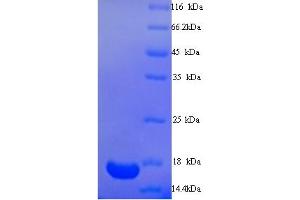 SDS-PAGE (SDS) image for Tripartite Motif Containing 24 (TRIM24) (AA 891-1012), (partial) protein (His tag) (ABIN5713914)