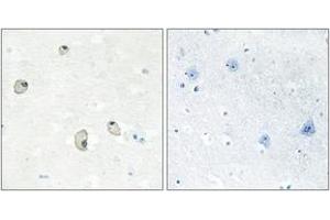 Immunohistochemistry analysis of paraffin-embedded human brain tissue, using CDH22 Antibody.