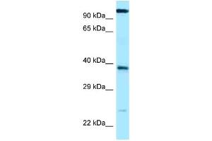 WB Suggested Anti-LOC647589 Antibody Titration: 1. (ANHX anticorps  (C-Term))