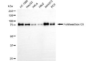 Western blotting analysis using forkhead box O3 antibody (ABIN7798646).