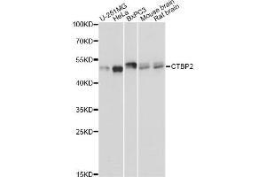 Western blot analysis of extracts of various cell lines, using CTBP2 Antibody (ABIN6290123) at 1:3000 dilution. (CTBP2 anticorps)