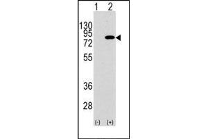 Image no. 1 for anti-Phosphoinositide 3 Kinase, p85 beta (PI3K p85b) (Tyr467) antibody (ABIN360466)