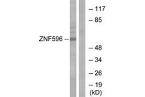 Western Blotting (WB) image for anti-Zinc Finger Protein 596 (ZNF596) (AA 261-310) antibody (ABIN2879157) (ZNF596 anticorps  (AA 261-310))
