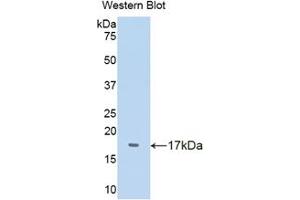 Western blot analysis of the recombinant protein. (TTR anticorps  (AA 20-147))