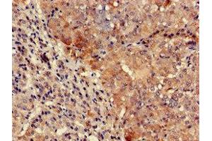 Immunohistochemistry of paraffin-embedded human adrenal gland tissue using ABIN7161691 at dilution of 1:100 (TYK2 anticorps  (AA 286-372))