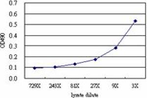 PPBP (Human) Matched Antibody Pair