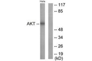 Western blot analysis of extracts from HeLa cells, treated with Insulin 0. (AKT1 anticorps  (AA 292-341))