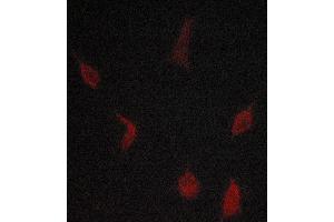 ABIN6268894 staining lovo cells by ICC/IF. (TGFBR1 anticorps  (Internal Region))
