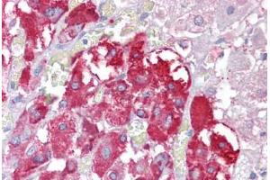 Anti-TPTE antibody IHC staining of human adrenal. (TPTE anticorps  (AA 371-383))