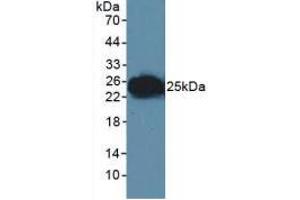 Figure. (F11R anticorps  (AA 64-249))