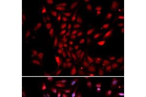 Immunofluorescence analysis of U2OS cells using KPNA4 Polyclonal Antibody (KPNA4 anticorps)