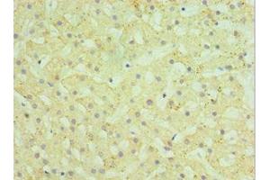 Immunohistochemistry of paraffin-embedded human liver tissue using ABIN7155970 at dilution of 1:100 (HYAL1 anticorps  (AA 136-435))