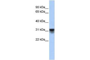 WB Suggested Anti-KDELR3 Antibody Titration:  0. (KDELR3 anticorps  (Middle Region))