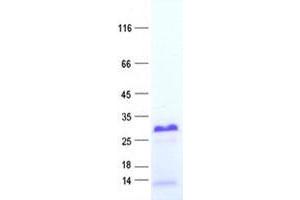 Validation with Western Blot (X Antigen Family, Member 3 (XAGE3) protein (His tag))
