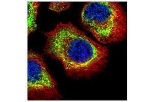 ICC/IF Image Confocal immunofluorescence analysis (Olympus FV10i) of methanol-fixed A431, using alpha Adducin, antibody (Green) at 1:500 dilution. (alpha Adducin anticorps)