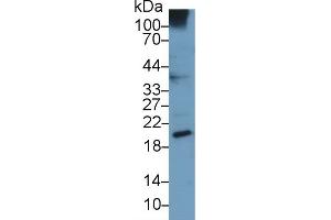 Detection of UCN3 in Human A549 cell lysate using Monoclonal Antibody to Urocortin 3 (UCN3) (UCN3 anticorps  (AA 22-161))