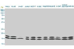 NME1 monoclonal antibody (M02), clone 1D7.