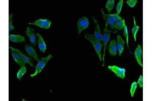 Immunofluorescent analysis of Hela cells using ABIN7153235 at dilution of 1:100 and Alexa Fluor 488-congugated AffiniPure Goat Anti-Rabbit IgG(H+L)