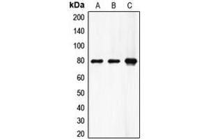 Western blot analysis of Factor XIII A expression in HeLa (A), A549 (B), rat heart (C) whole cell lysates.