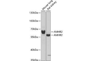 Western blot analysis of extracts of various cell lines, using  antibody  at 1:1000 dilution.