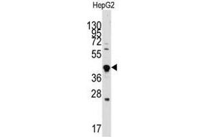 Image no. 2 for anti-Growth Differentiation Factor 3 (GDF3) (Center) antibody (ABIN357460) (GDF3 anticorps  (Center))