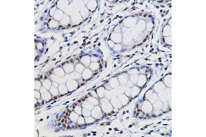 Immunohistochemistry of paraffin-embedded human colon using METTL14 Rabbit pAb (ABIN6131104, ABIN6143759, ABIN6143760 and ABIN6224625) at dilution of 1:100 (40x lens). (METTL14 anticorps  (AA 1-210))