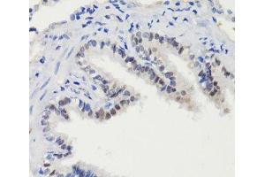 Immunohistochemistry of paraffin-embedded Rat lung using Phospho-Stat3(S727) Polyclonal Antibody at dilution of 1:100 (40x lens). (STAT3 anticorps  (pSer727))