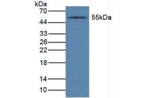 Detection of CYP1A1 in Mouse Liver Tissue using Polyclonal Antibody to Cytochrome P450 1A1 (CYP1A1)
