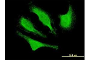 Immunofluorescence of monoclonal antibody to CDK5R1 on HeLa cell.