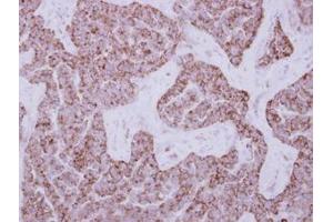 anti-Dihydrouridine Synthase 2-Like (DUS2L) (AA 1-199) antibody