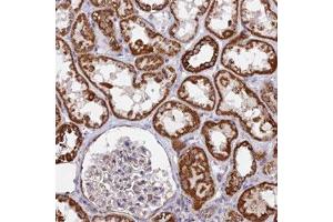 Immunohistochemical staining (Formalin-fixed paraffin-embedded sections) of human kidney with CDC16 polyclonal antibody  shows strong cytoplasmic positivity in cells in tubules. (CDC16 anticorps)