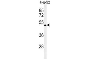 Western Blotting (WB) image for anti-Opsin 1 (Cone Pigments), Medium-Wave-Sensitive (OPN1MW) antibody (ABIN3002167)