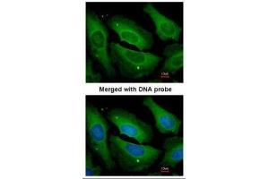 ICC/IF Image Immunofluorescence analysis of paraformaldehyde-fixed HeLa, using PP1 gamma, antibody at 1:200 dilution.