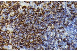 Immunohistochemistry of paraffin-embedded Mouse spleen using APOC3 Polyclonal Antibody at dilution of 1:100 (40x lens).